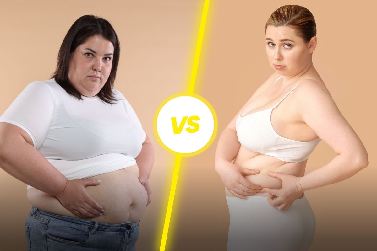 Visceral vs. Subcutaneous fat