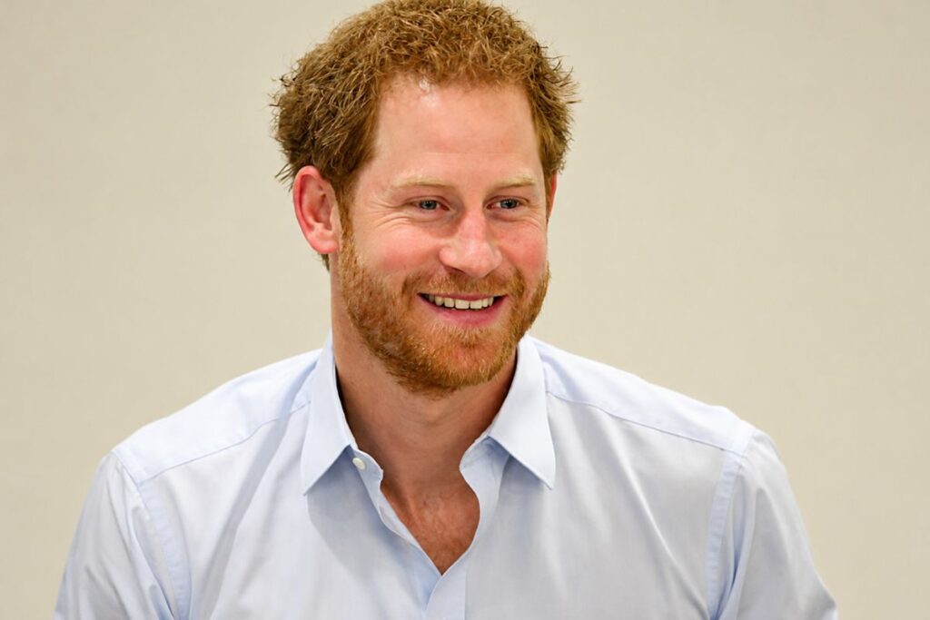What Sparked the Prince Harry Hair Transplant Rumour